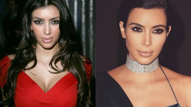 En cuestión de nueve años Kim Kardashian ha pasado por el quirófano más de diez veces. 