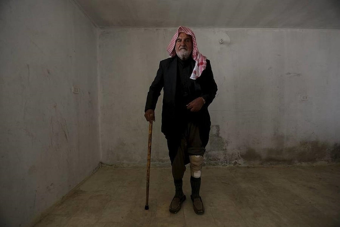 Un hombre con una pierna amputada posa con su nueva prótesis y un bastón. 