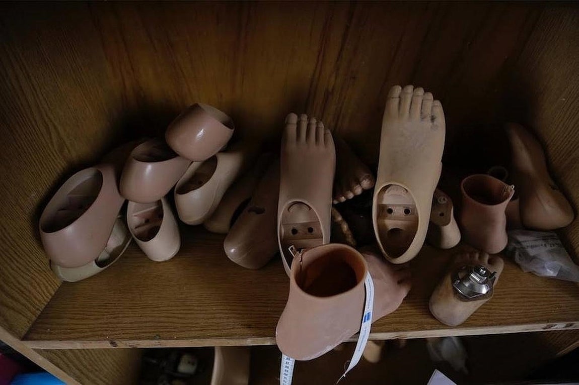 Prótesis fabricadas por los dos jóvenes. 