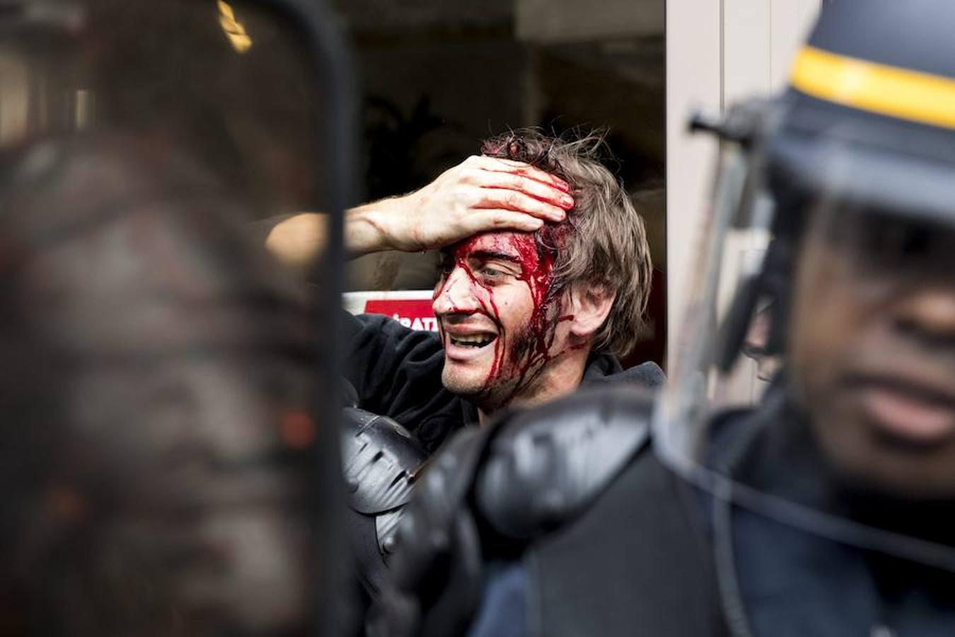 Vista de un manifestante herido durante la manifestación