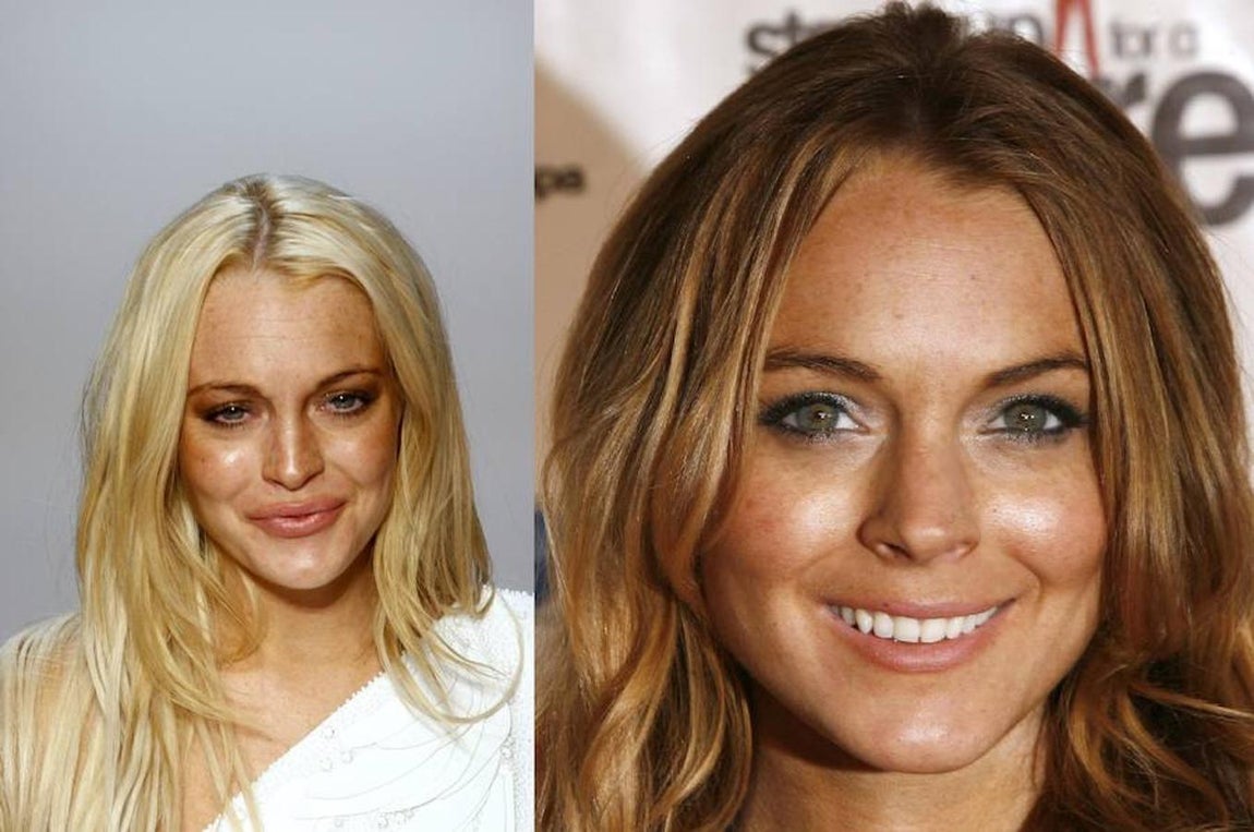 Lindsay Lohan. 