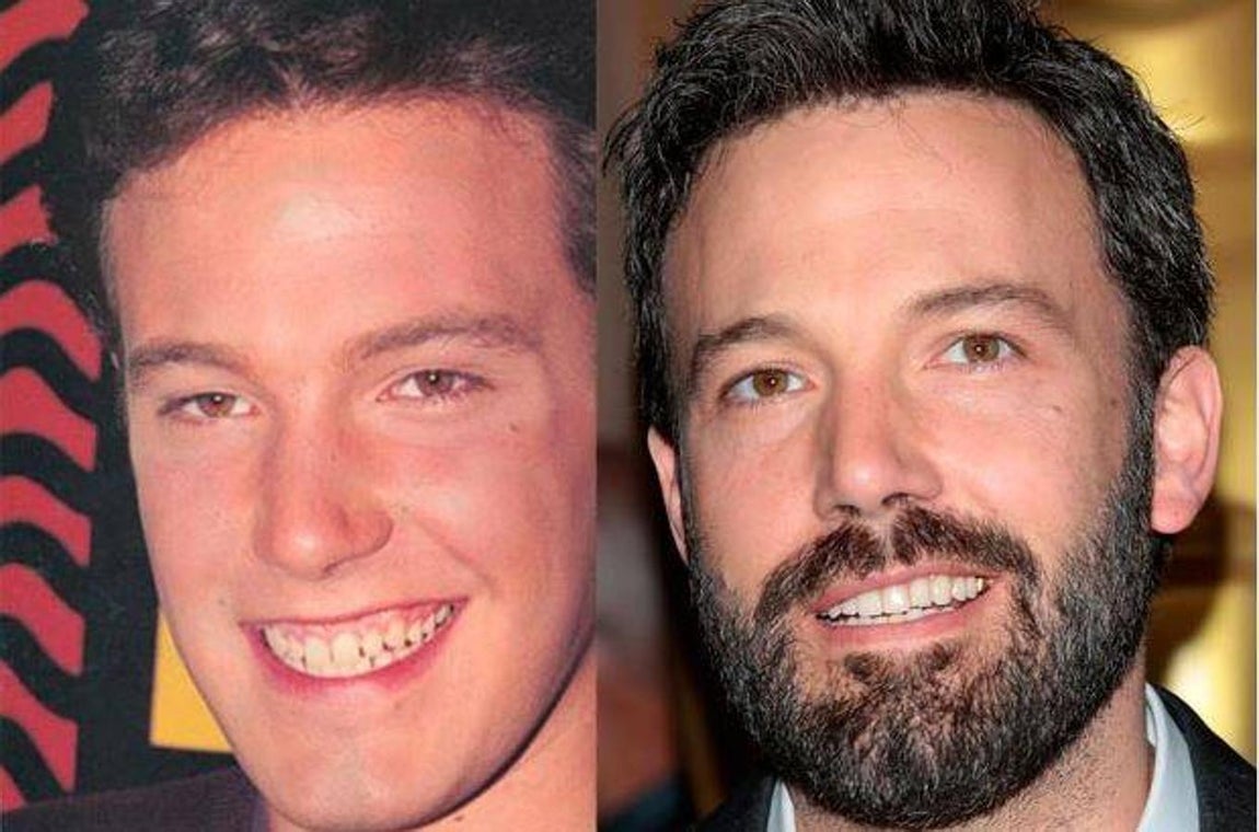Ben Affleck. 
