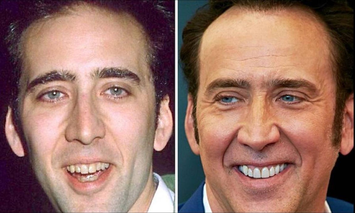 Nicolas Cage. 