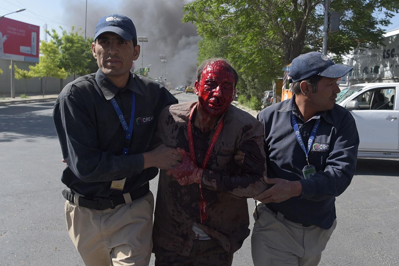 En imágenes: El terrible atentado en Kabul