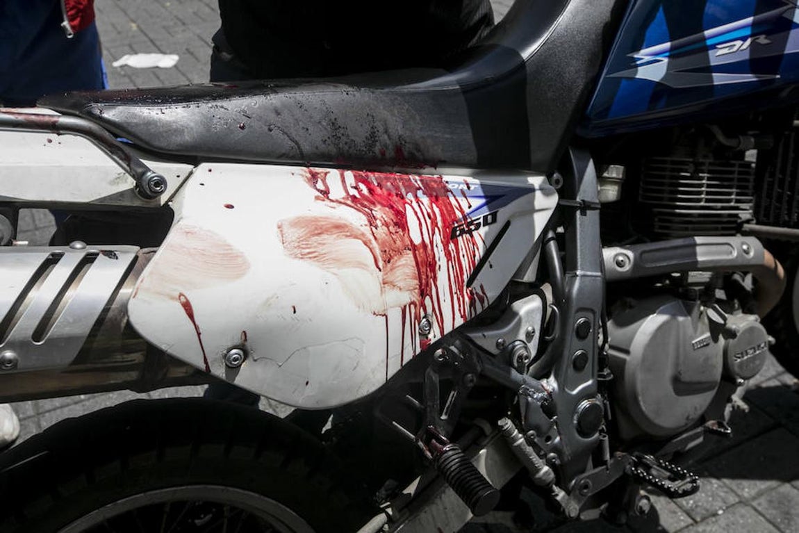 Restos de sangre de un simpatizante del Gobierno que resulto herido en una pelea en la Asamblea Nacional.. 