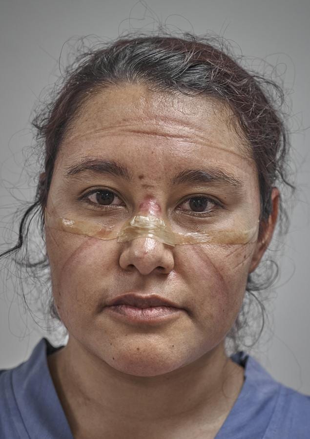 (Nominada en la categoria de 'Retrato') Una doctora de la Ciudad de México muestra, al final de su turno, las marcas dejadas por la mascarilla y las gafas protectoras claramente visibles en su rostro. 