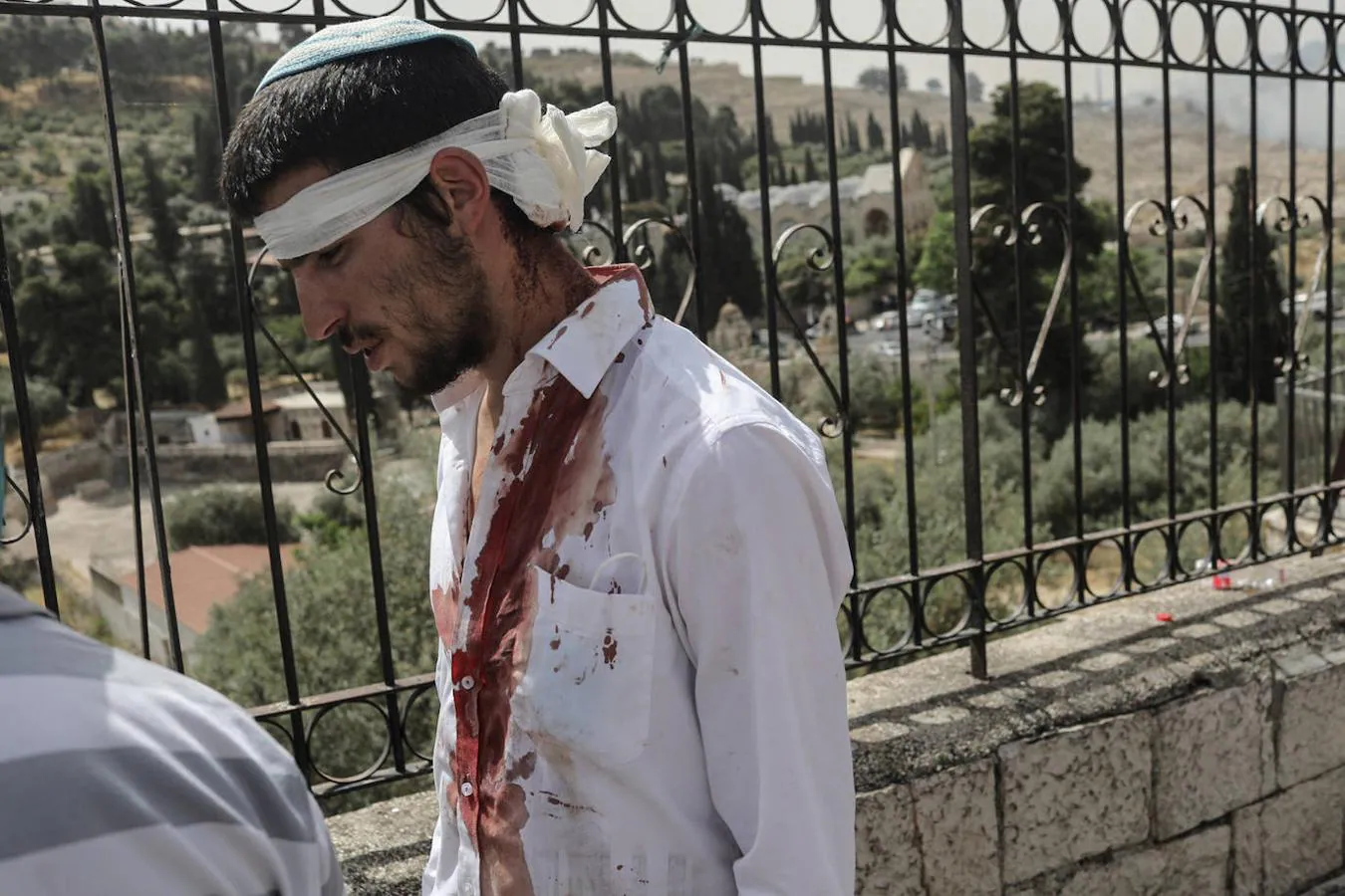 Más de 300 personas -incluidos 20 agentes- han resultado heridas en los enfrentamientos entre manifestantes palestinos y policías israelíes en Jerusalén desde el pasado viernes, según fuentes sanitarias. 