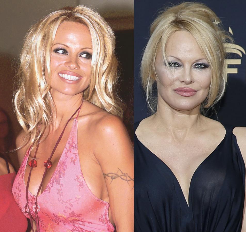 Pamela Anderson. 