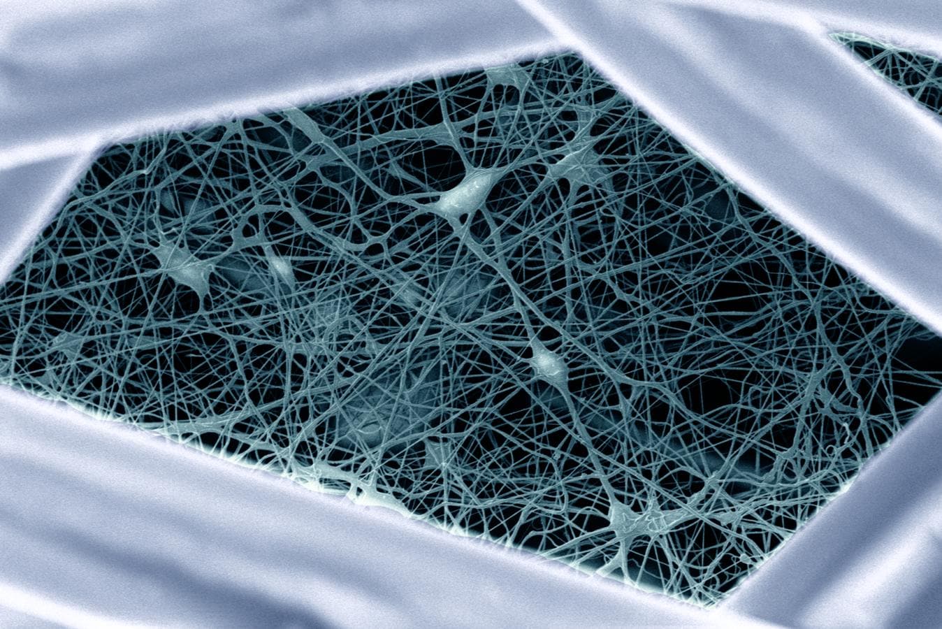 Pequeña Gran Muralla. La foto muestra el filtro de una mascarilla FFP2 al microscopio. Sus nanofibras dejan pasar el aire que respiramos, pero forman una red que atrapa las pequeñas gotas que exhalamos: el vehículo por el que viajan virus como el SARS-CoV-2, causante de la COVID-19, o la influenza, causante de la gripe.. 