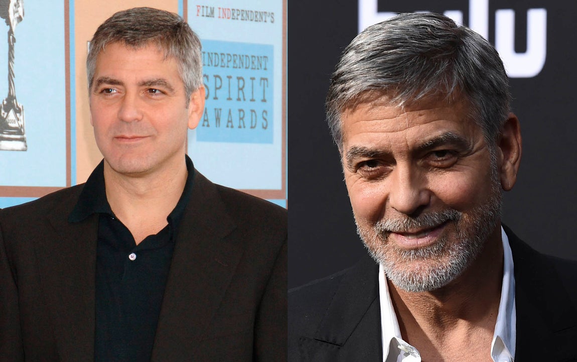 George Clooney. Su pelo apenas ha cambiado en los últimos 20 años, lo que hace sospechar que George Clooney también ha recurrido al injerto capilar para aumentar su densidad y evitar la alopecia.
