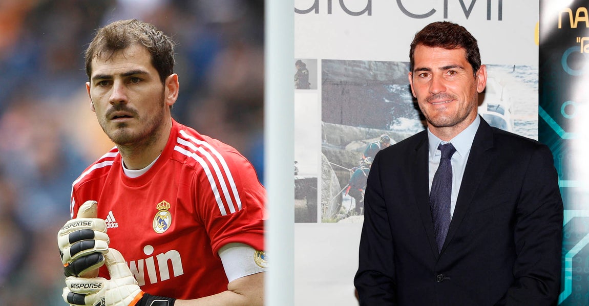 Iker Casillas. Y también ha sido muy comentado el trasplante del portero, aunque nunca lo ha confirmado. Pero sí parece evidente que hace años lucía un cabello más fino y, en la actualidad, Casillas puede presumir de pelo denso.