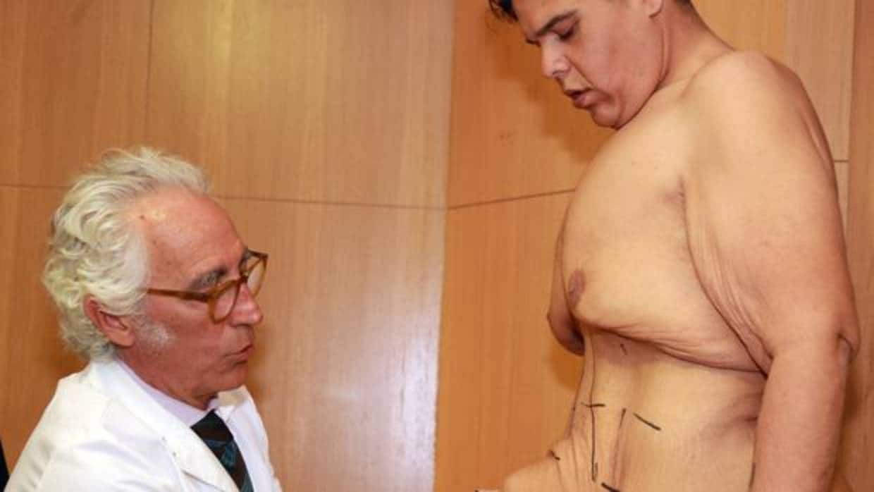 El doctor Carlos Ballesta muestra el marcaje para retirar 20 kilos de piel del abdomen de Juan Manuel Heredia