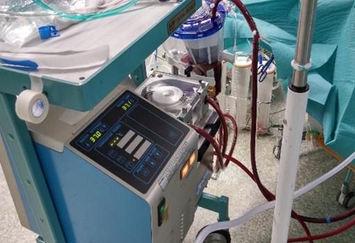 Maquinaria ECMO para el transporte de órganos en asistolia sin que se deterioren