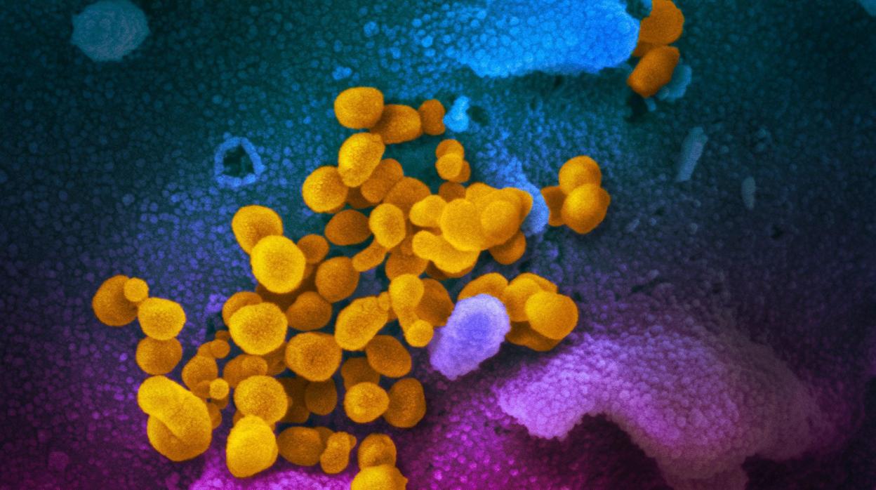 Imagen tomada con un microscopio de altísima resolución con el Covid-19 en amarillo