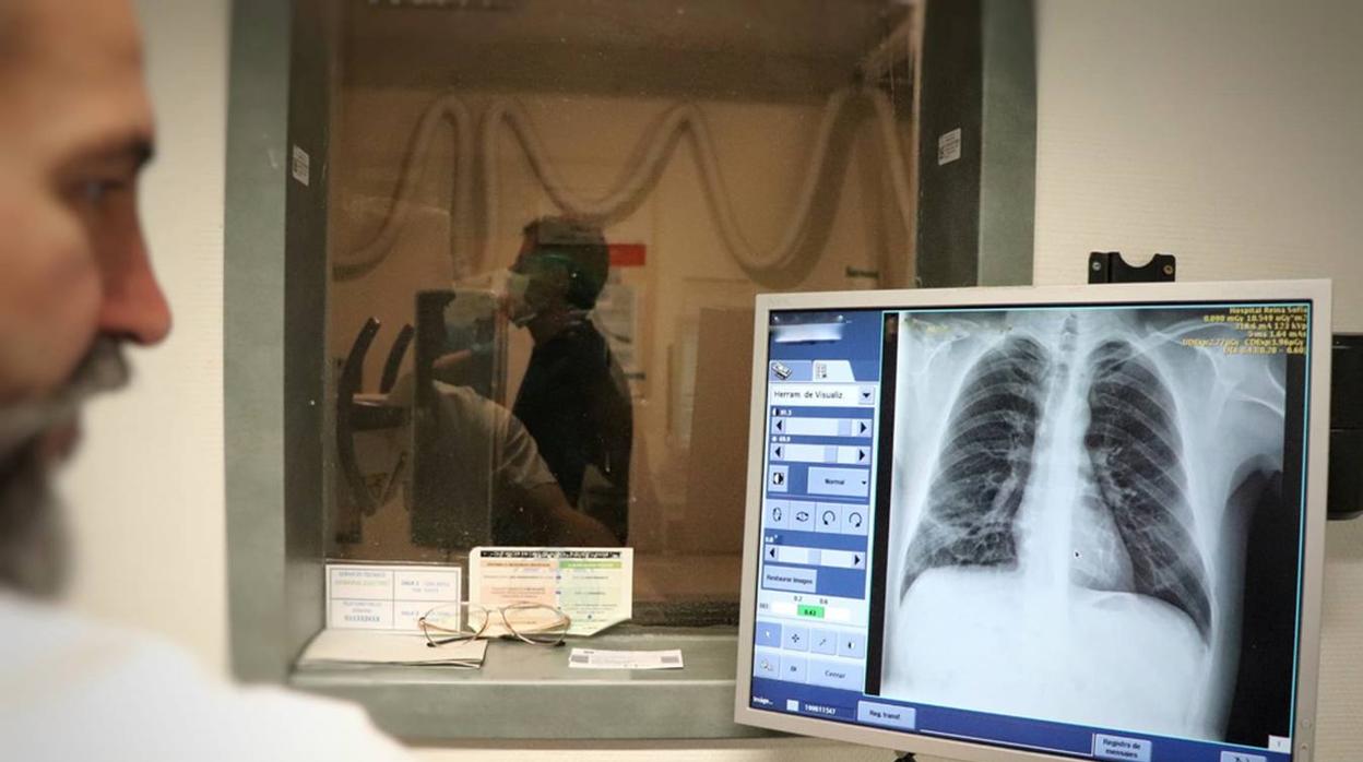 Una radiografía pulmonar en el Hospital Reina Sofía de Córdoba