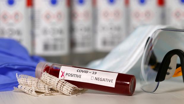 Andalucía espera contar este año con 300.000 dosis de la vacuna de Oxford para el coronavirus