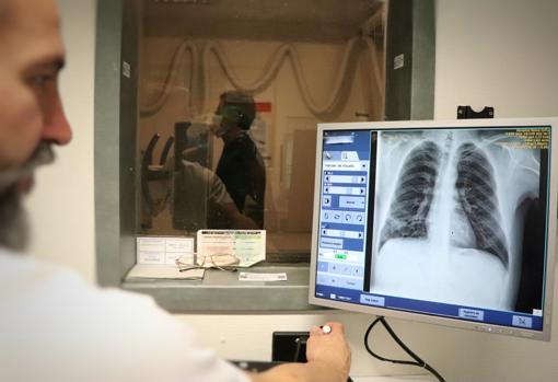 Un paciente se somete a una radiografía pulmonar