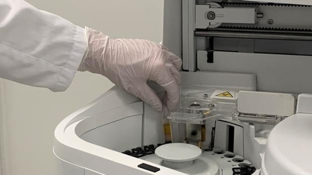 ¿Cómo saber el grado de inmunidad frente al Covid tras la vacuna? Este test de Quirónsalud de Córdoba lo mide