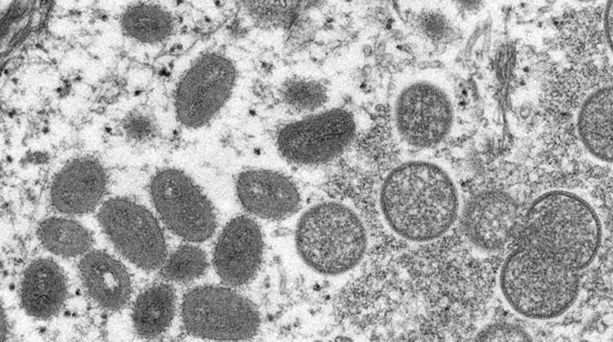 El virus del mono observado con un microscopio