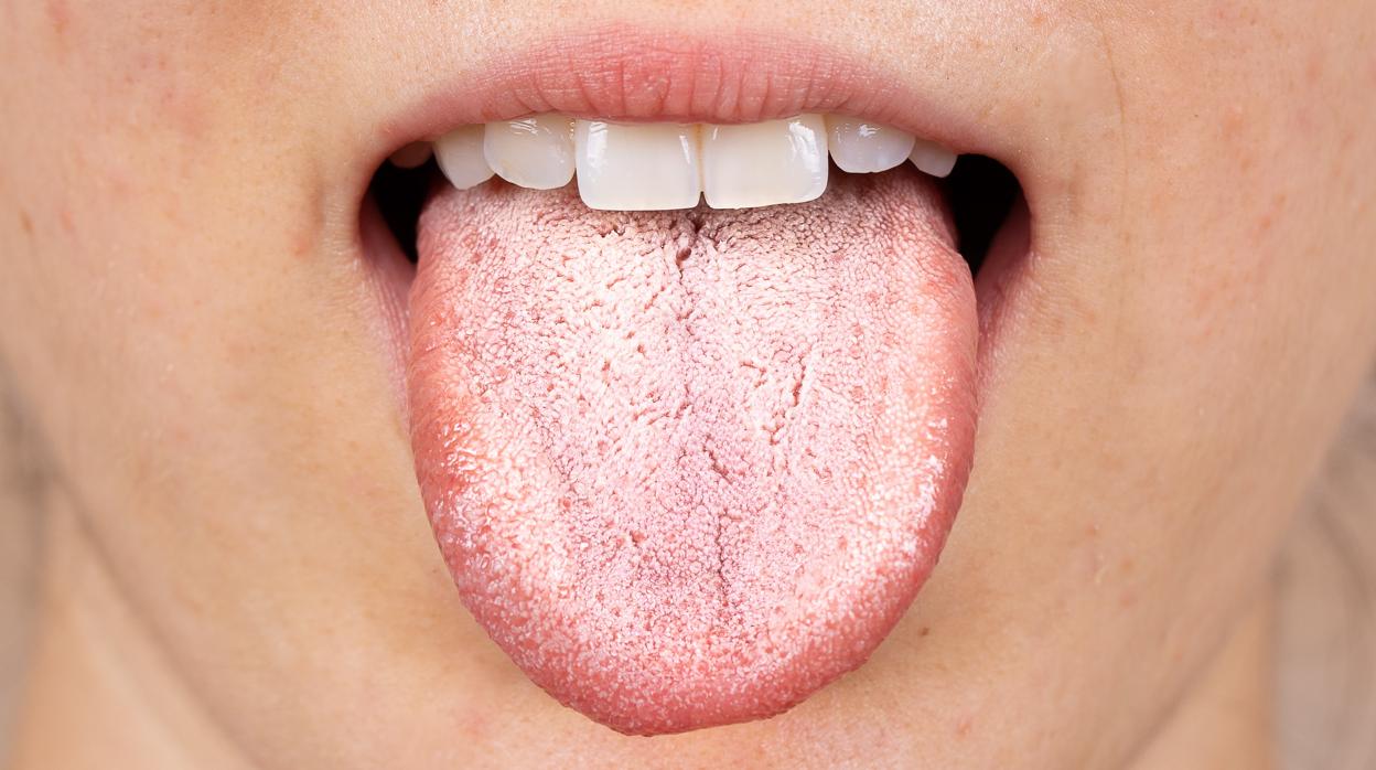 ¿Por qué a veces tenemos la lengua blanca?