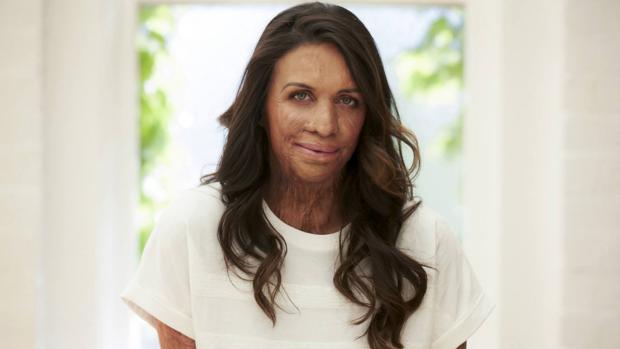 Turia Pitt: «En lugar de obsesionarme con lo que me pasó, dirigí mi energía a crearme una buena vida»