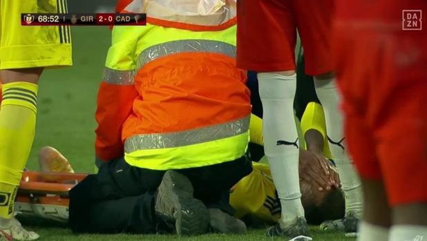 El menisco de Akapo, dañado