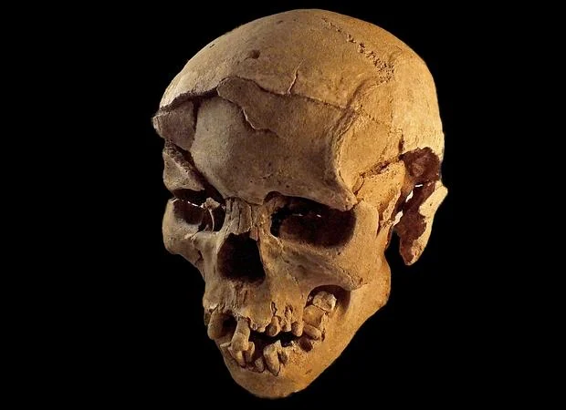 Cráneo de un hombre con múltiples lesiones causadas por un objeto contundente, como un palo