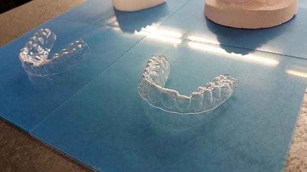 Este es el resultado final de una ortodoncia creada por una impresora 3D