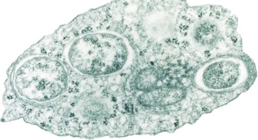 Fotorafía de microscopio electrónico de una célula de insecto infectada con bacterias del género Wolbachia