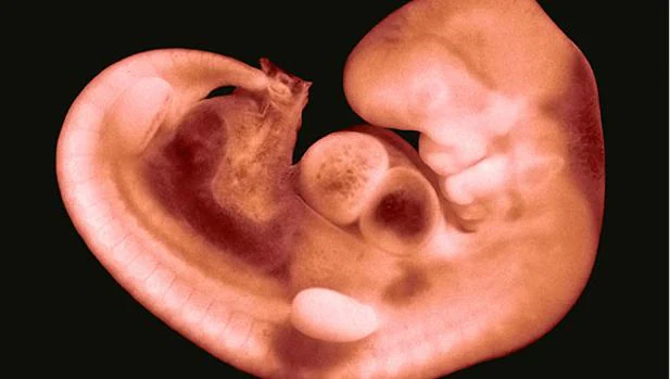 Un embrión humano de 30 días. El corazón es el primer órgano en formarse