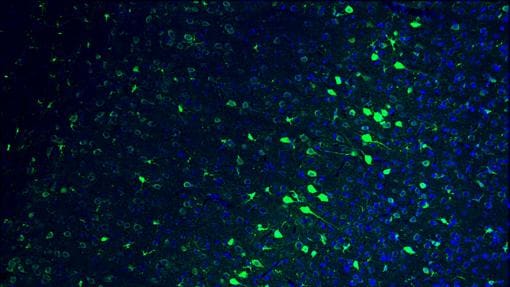 Parte del cerebro de un ratón adulto. En azul, los núcleos de las células y en verde, las neuronas editadas genéticamente