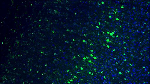 Parte del cerebro de un ratón adulto. En azul, los núcleos de las células y en verde, las neuronas editadas genéticamente