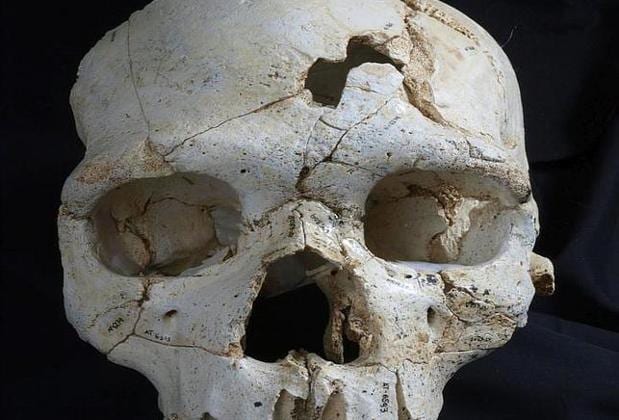 Vista frontal del Cráneo 17, con los dos impactos que causaron la muerte del individuo