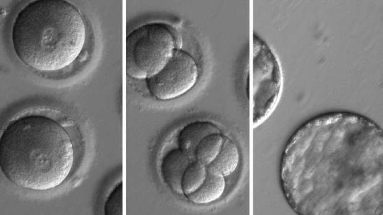 Secuencia al microscopio de los primeros embriones que se corrigieron con éxito para eliminar una enfermedad hereditaria del corazón que causa la muerte súbita