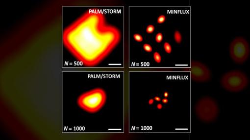 Comparación de metodologías de microscopia de fluorescencia