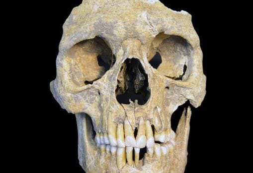 Restos de un hombre de 25 a 30 años infectado con el virus de la hepatitis B y encontrado en el yacimiento de la Edad de Piedra de Karsdorf, Alemania