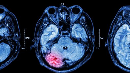 Algunos sugieren que la mayoría del cerebro no se usa para nada