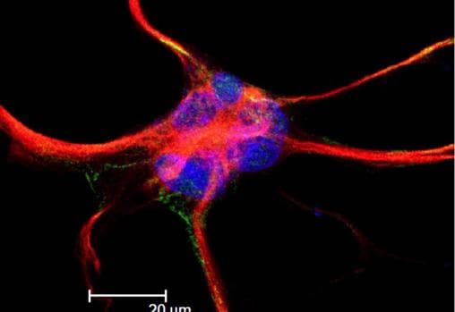 Un astrocito, una célula de apoyo de las neuronas, teñido con marcadores fluorescentes. Se han encontrado bacterias dentro de estas células