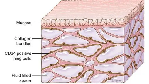 El intersticio, representado en la imagen, está bajo la piel y recubre pulmones, vasos sanguíneos, músculos, etc
