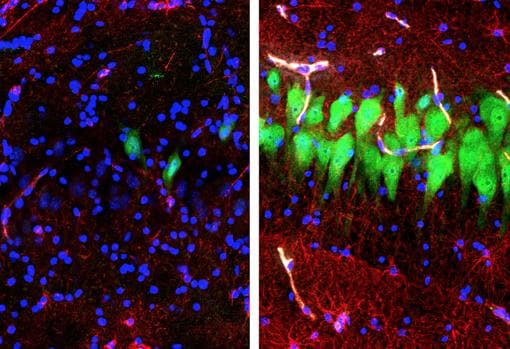 Vista de la región CA3 del hipocampo del cerebro: a la izquierda, diez horas después de la muerte sin tratamiento; a la derecha, el mismo tiempo pero después de someter al cerebro porcino a la tecnología BrainEx. En este periodo, las neuronas (verde) y los astrocitos (rojo) normalmente se desintegran a menos que el sistema BrainEx los recupere, como muestra la imagen