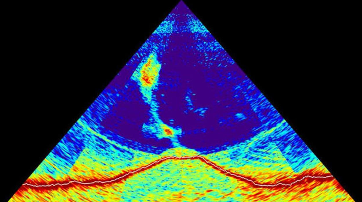 Imágenes del sonar de la erupción submarina ocurrida en la isla de Mayotte