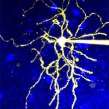 Imagen microscópica de una neurona expresando el receptor D2R