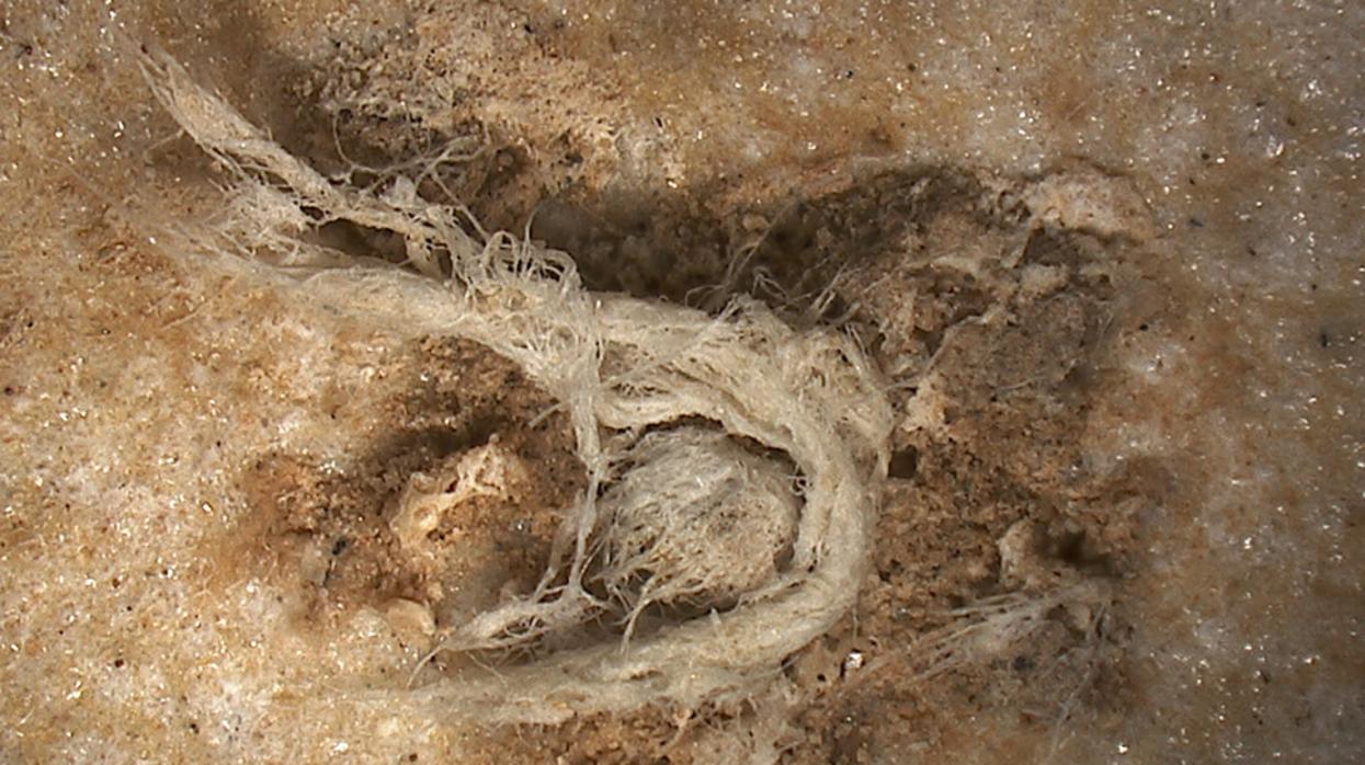 Fotografía del fragmento de cordón tomada por microscopía digital