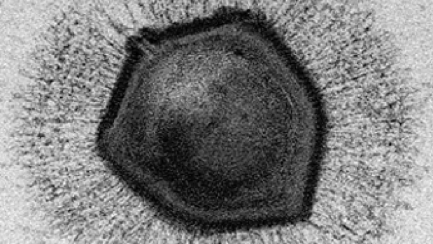 El increíble misterio de los virus gigantes