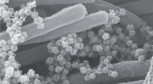 Otra imagen que muestra los viriones sobre los cilios