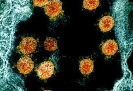 Fotografía de varios virus SARS-CoV-2, en naranja. Reconocen a las células a las que infectarán por medio de la proteína de la espícula