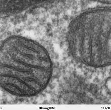 Dos mitocondrias vistas al microscopio