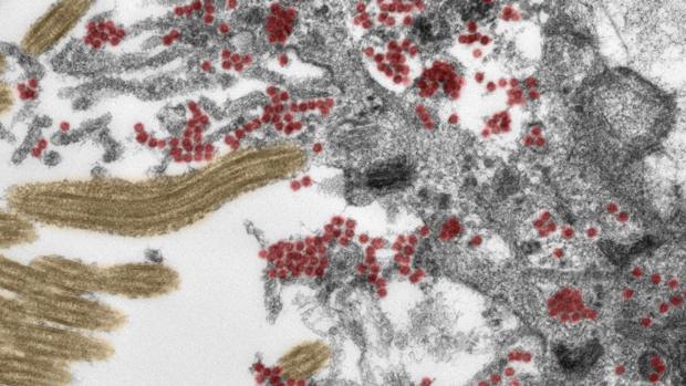 Descubren cómo el Covid-19 logra entrar en el cerebro