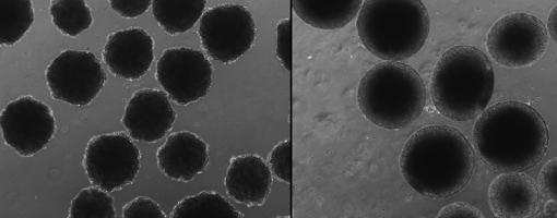 Los organoides cerebrales neandertales (izquierda) se ven muy diferentes a los organoides cerebrales humanos modernos (derecha)