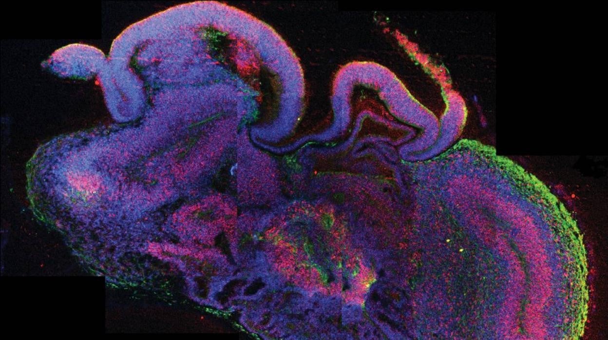 Sección de un organoide cerebral con regiones diferenciadas. En rojo se observan células madre neuronales y en verde, neuronas